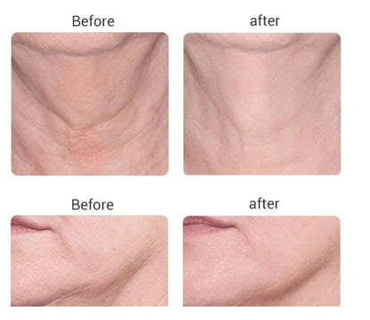 HarmonyBeauty - Faceliftapparaat Huidverjongingsapparaat | Lift En Verstevig Je Huid!